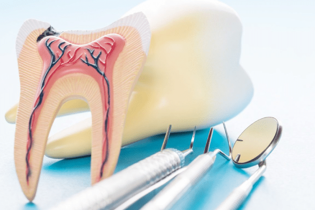 endodoncía
